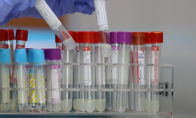 Sampel penelitian laboratorium, Sumber: liputan6.com