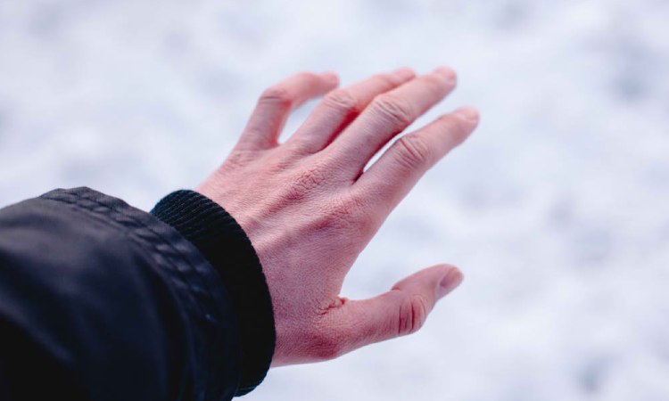 Apa itu frostbite, Sumber: alodokter.com