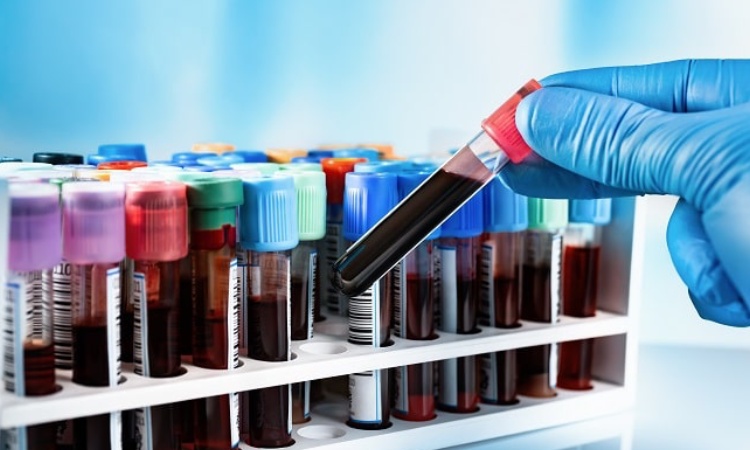 Sampel laboratorium, Sumber: cloudinary.com