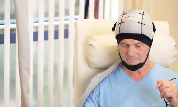 Cara menggunakan cold capping, Sumber: liverpoolecho.co.uk