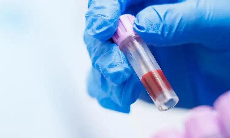 Cara simpan sampel biologis, Sumber: sciencedaily.com